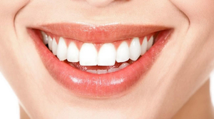 Clareamento de Dentes Clareamento de Dentes