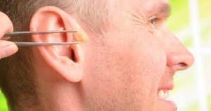 Reflexoterapia+Auricular